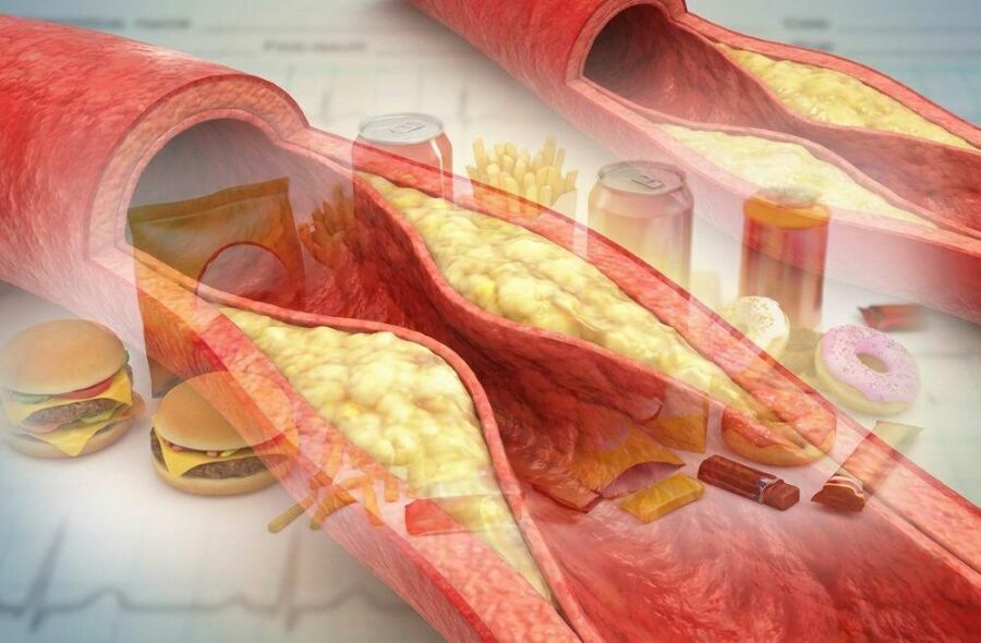 Image: Chronic diseases don't appear suddenly; they are built up meal after meal.